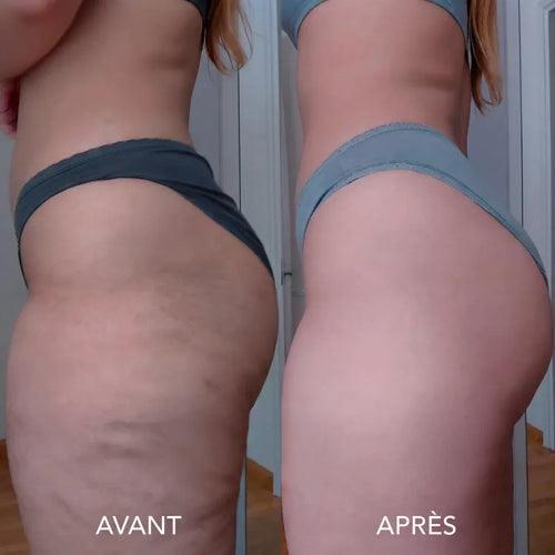 Huile de massage anti-cellulite Orvelia