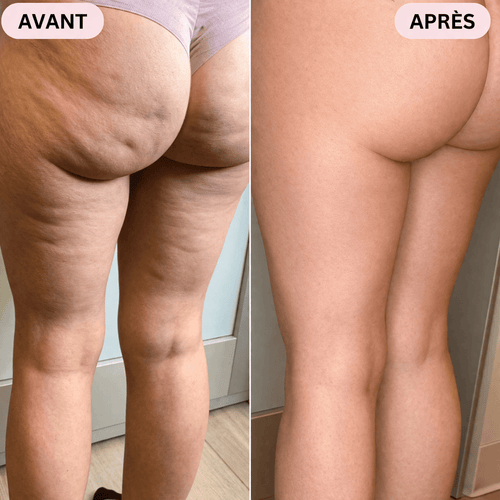 Huile de massage anti-cellulite Orvelia